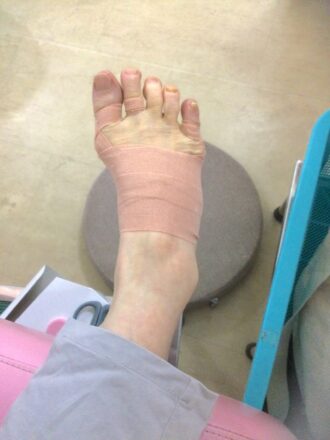 60代女性（日野市）施術後