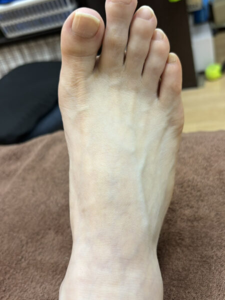 50代女性（鶴ヶ島市からお越しの方）施術前