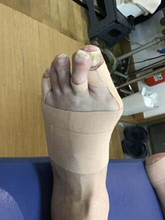 60代男性（練馬区）施術後