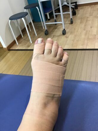 50代女性（練馬区）施術後