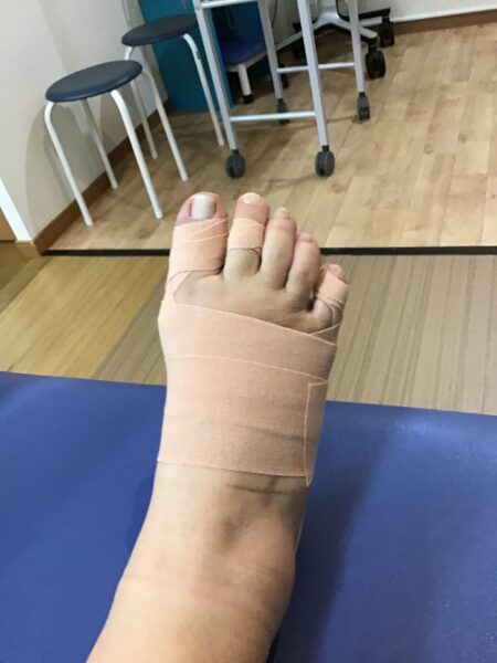 施術後
