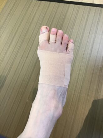 50代女性（練馬区）施術後