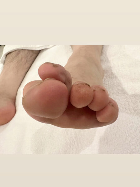 50代男性(港区からお越しの方)施術前