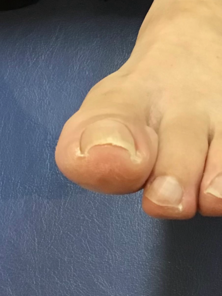 50代女性（練馬区からお越しの方）施術前