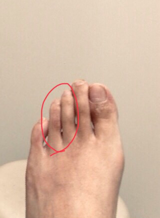 50代男性(大宮市からお越しの方)施術後