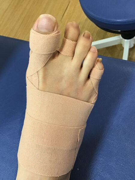 施術後