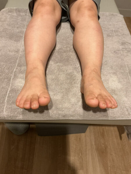 40代女性(北千住からお越しの方)施術前