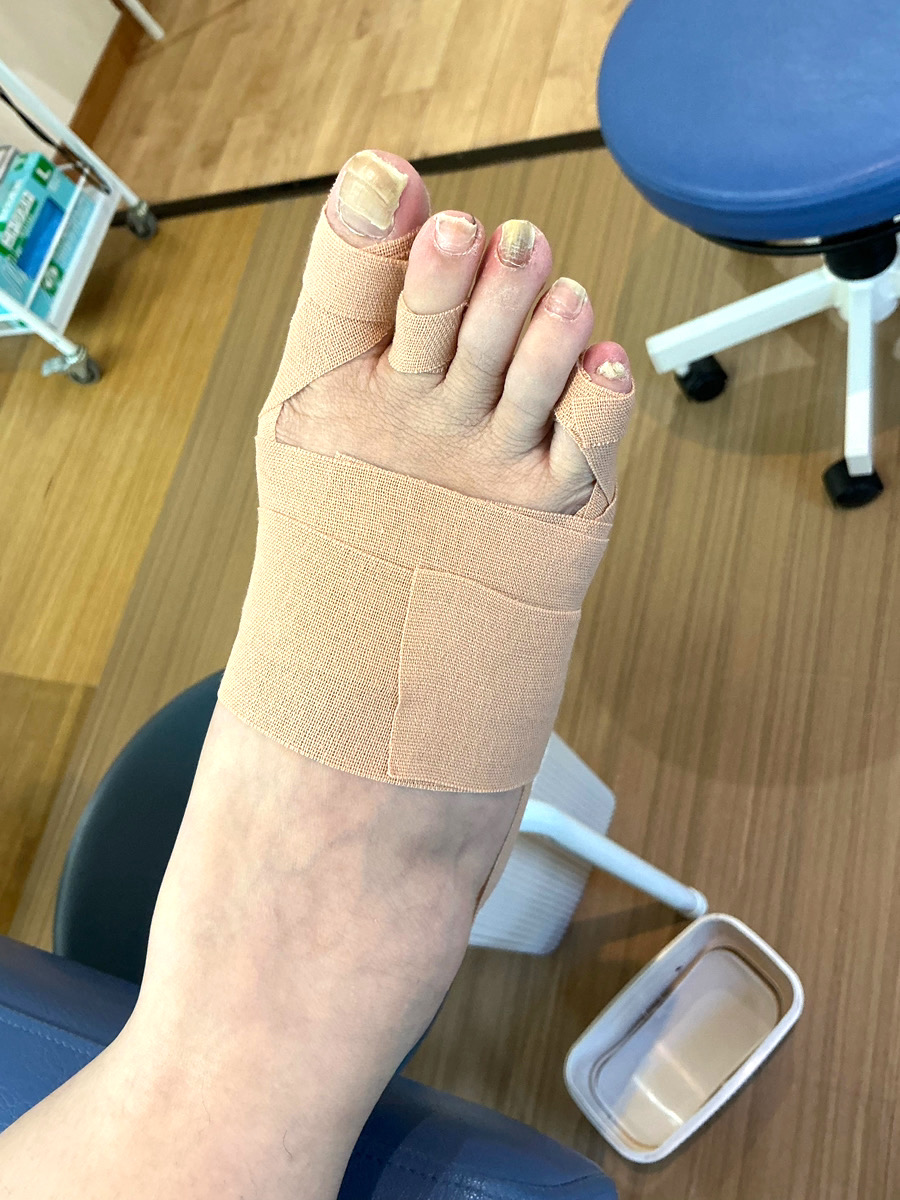 40代女性（練馬区）施術後