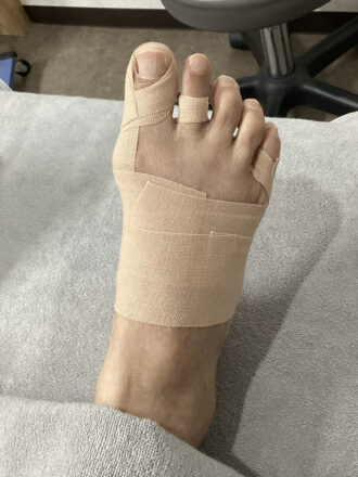 70代男性（境町）施術後