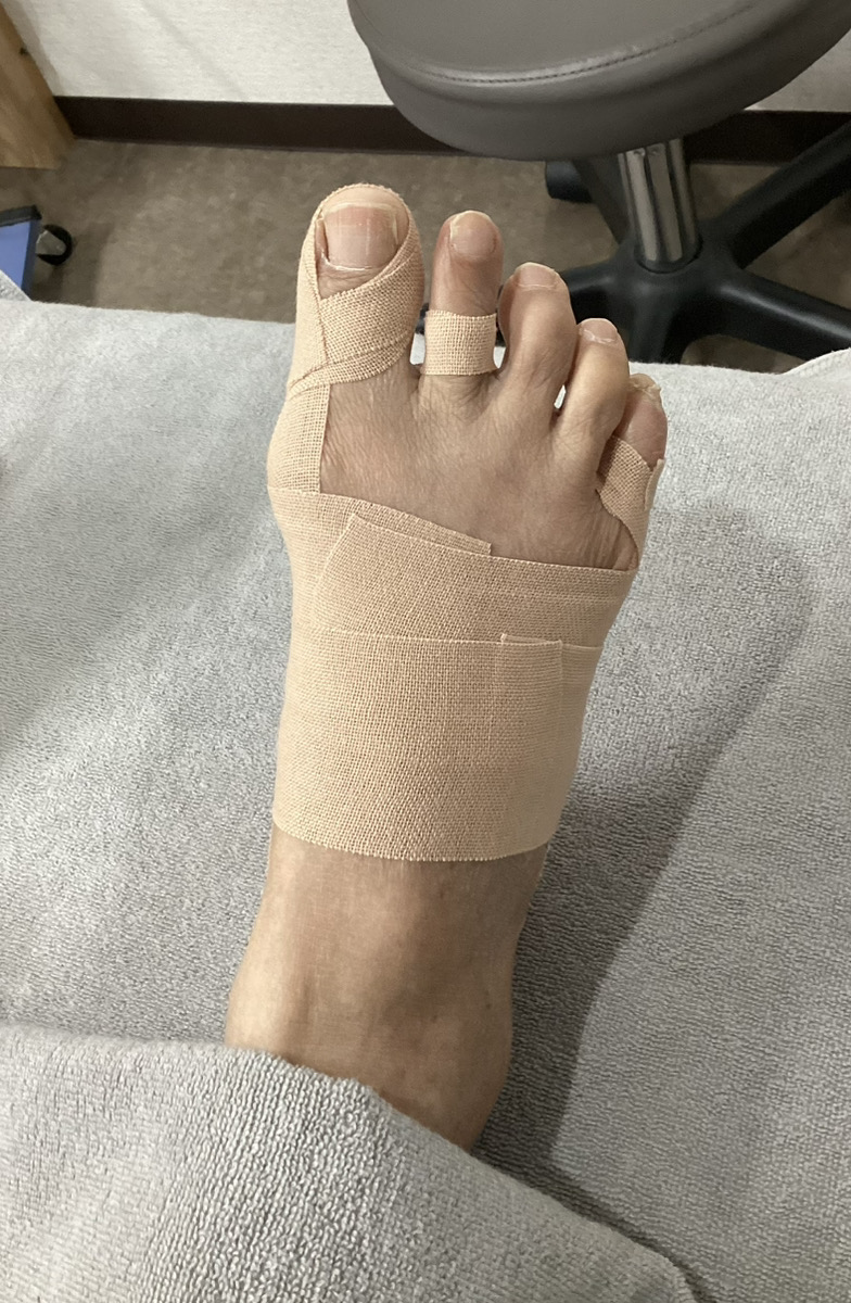 70代男性（境町）施術後