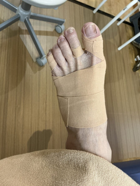 70代女性（練馬区からお越しの方）施術後