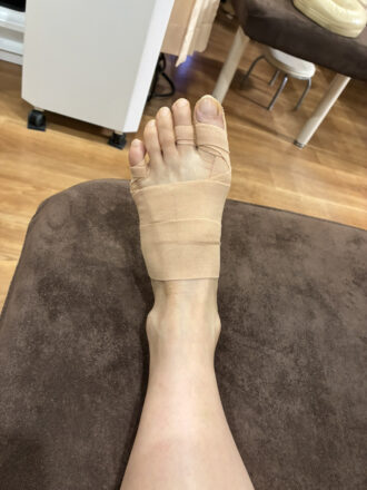 60代女性（福島市）施術後