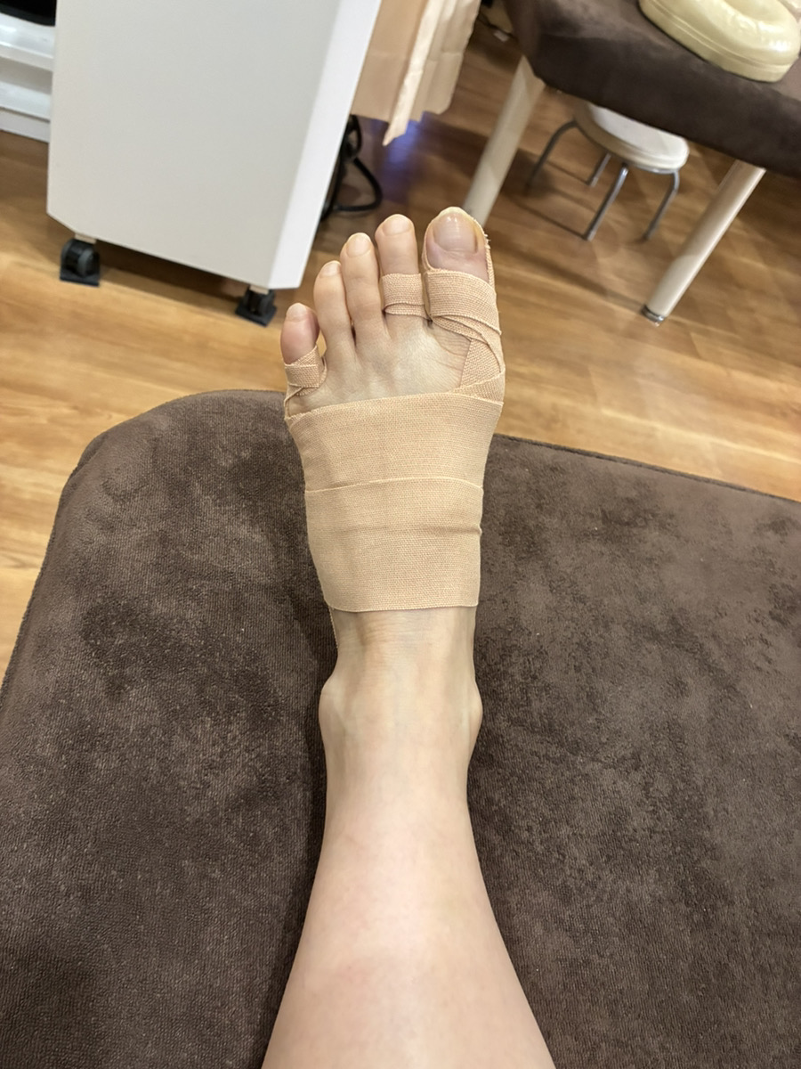 60代女性（福島市）施術後