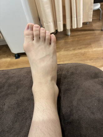 10代男性（郡山市）施術前