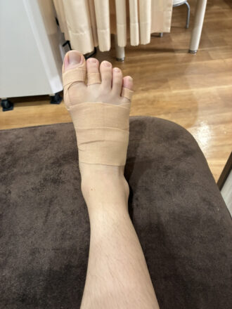 10代男性（郡山市）施術後