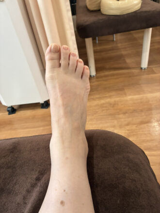 60代女性（須賀川市）施術前