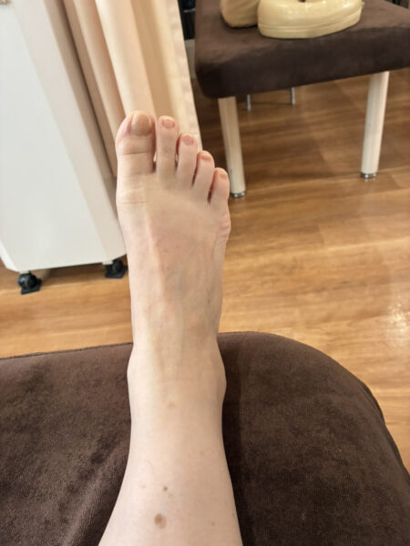 60代女性（須賀川市）施術前