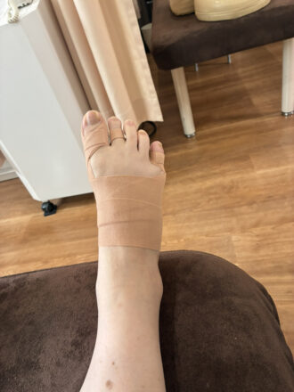 60代女性（須賀川市）施術後