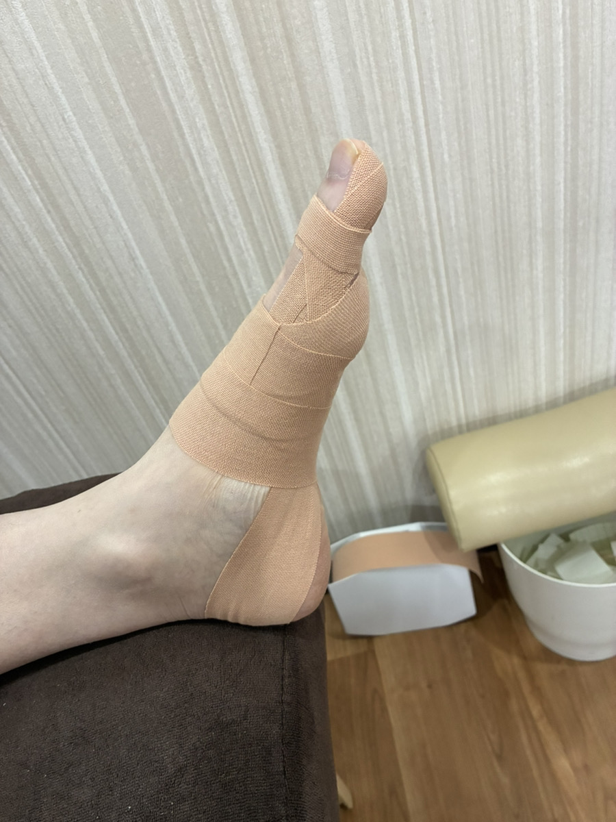 50代男性（郡山市）施術後