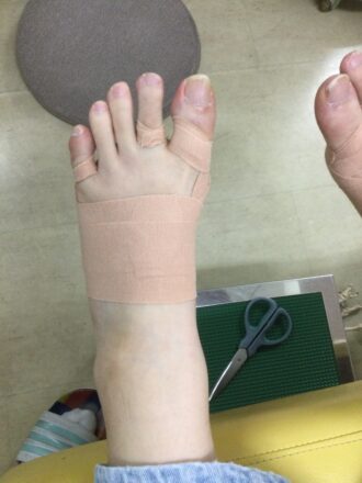 40代女性（八王子市）施術後