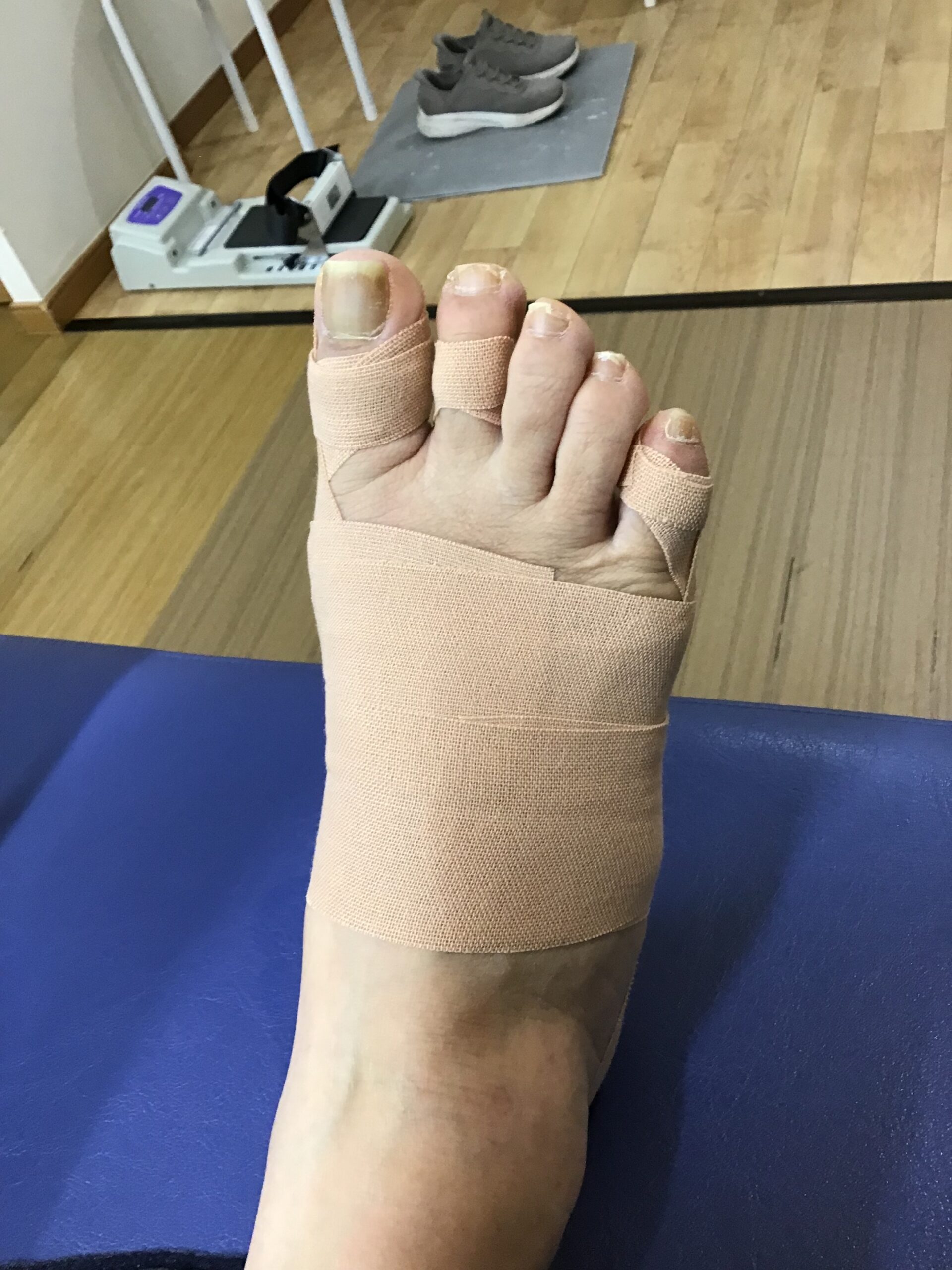 50代女性（練馬区）施術後