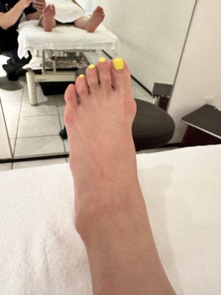 40代女性（千代田区からお越しの方）施術前