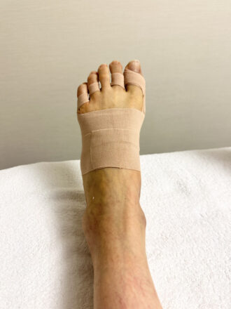 女性（代々木）施術後