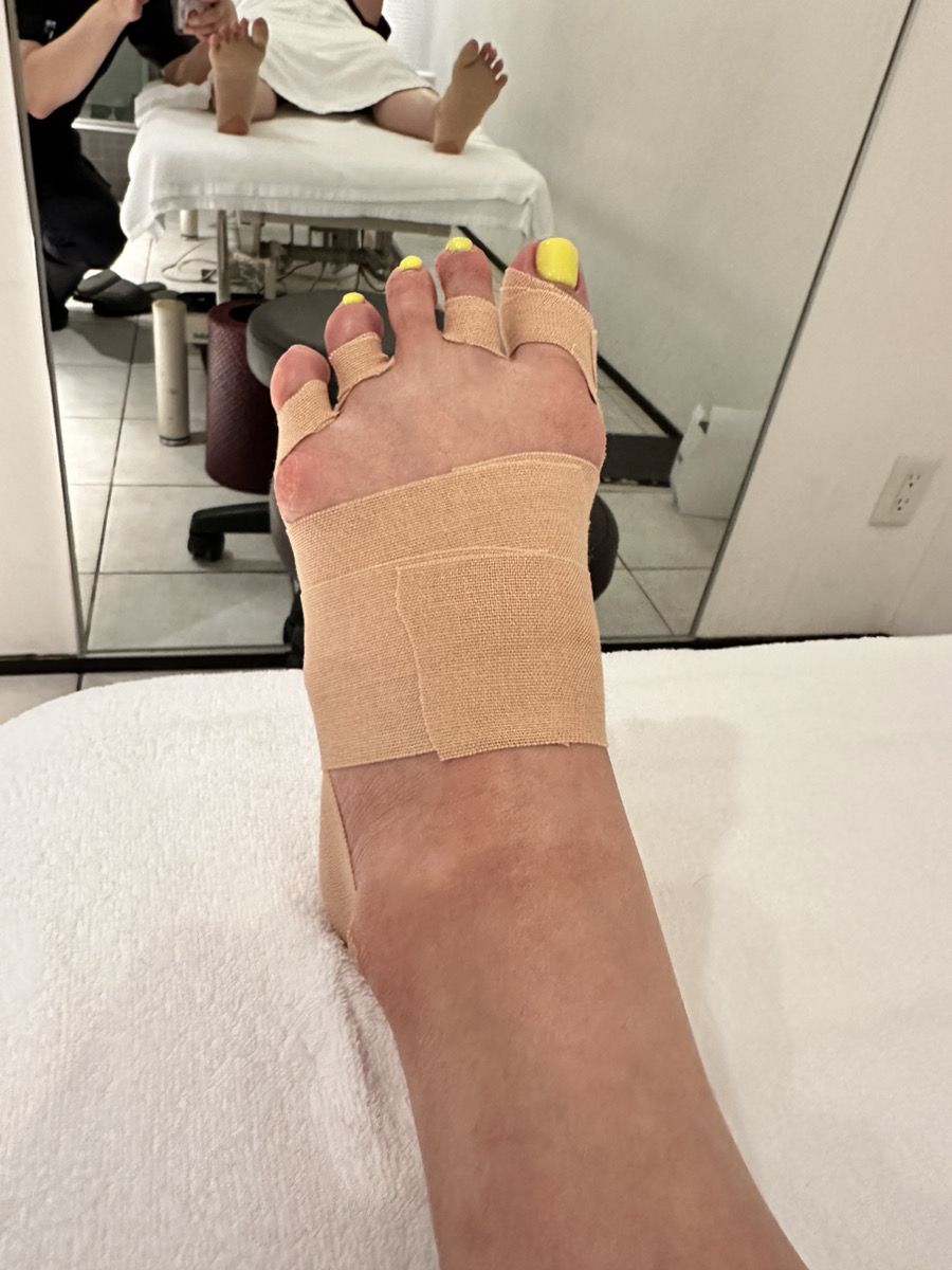 40代女性（千代田区）施術後