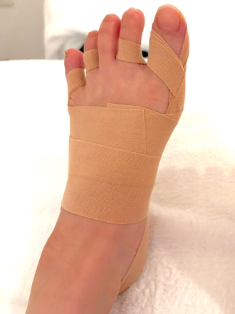 30代女性（千代田区）施術後