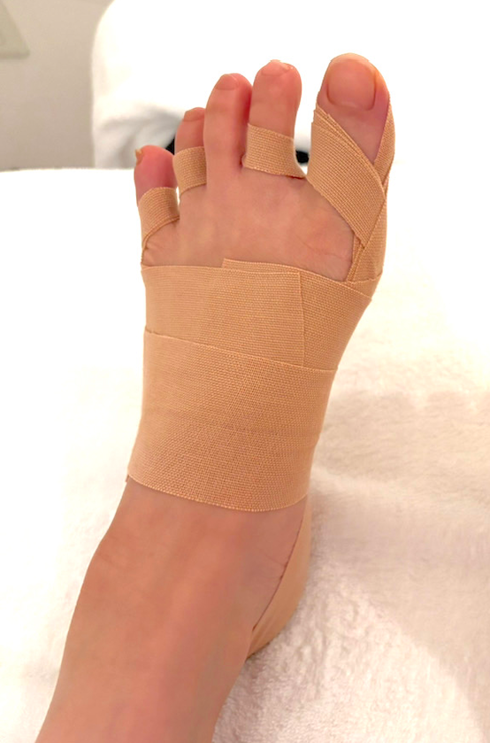 30代女性（千代田区）施術後