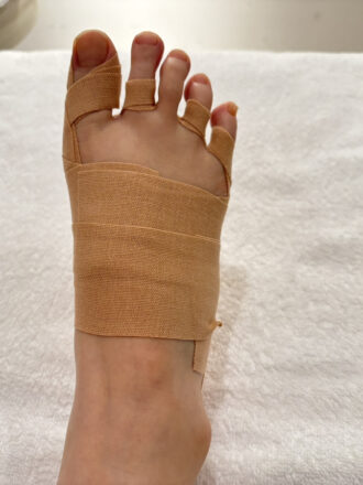 40代女性（港区）施術後