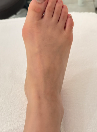 50代女性（港区）施術前