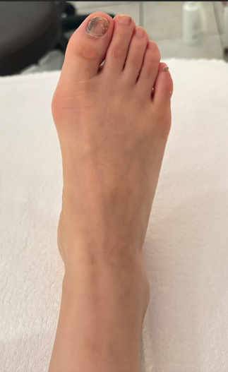 50代女性（港区からお越しの方）施術前