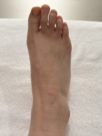 40代女性（港区）施術前