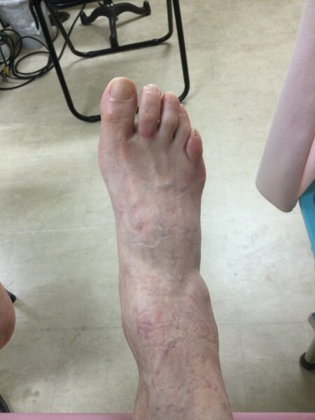 50代女性（八王子からお越しの方）施術前