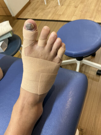 50代男性（練馬区）施術後