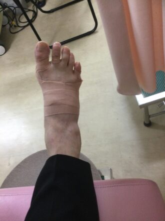 50代女性（八王子）施術後