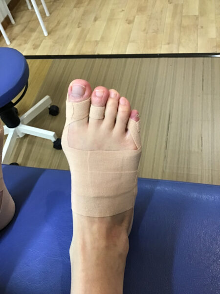 50代女性（練馬区からお越しの方）施術後