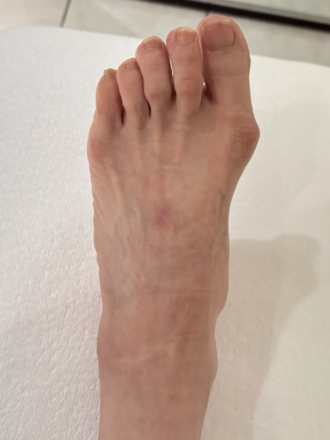 70代女性（港区）施術前