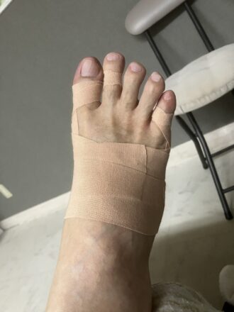 70代男性（小平市）施術後