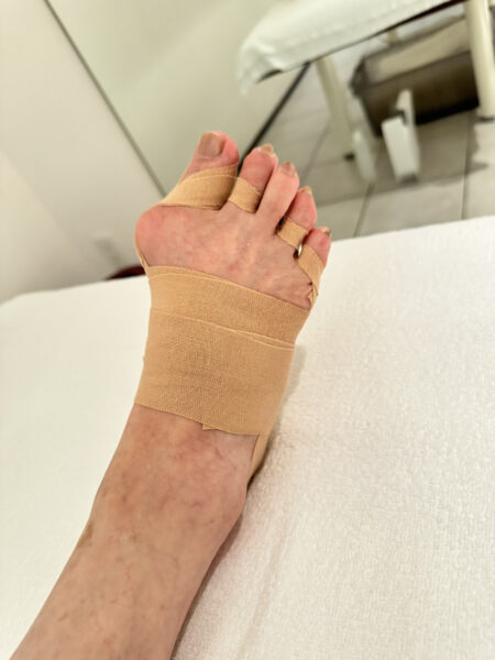 60代女性（千代田区）施術後