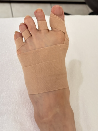 70代女性（港区）施術後