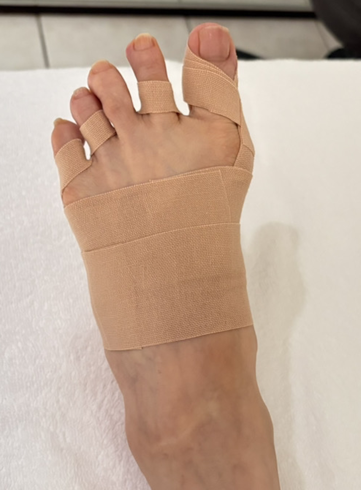 70代女性（港区）施術後