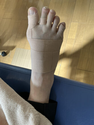 60代女性（練馬区）施術後