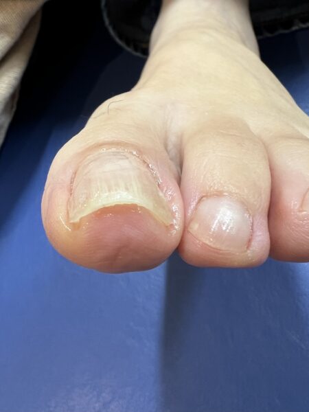 50代女性（練馬区からお越しの方）施術後