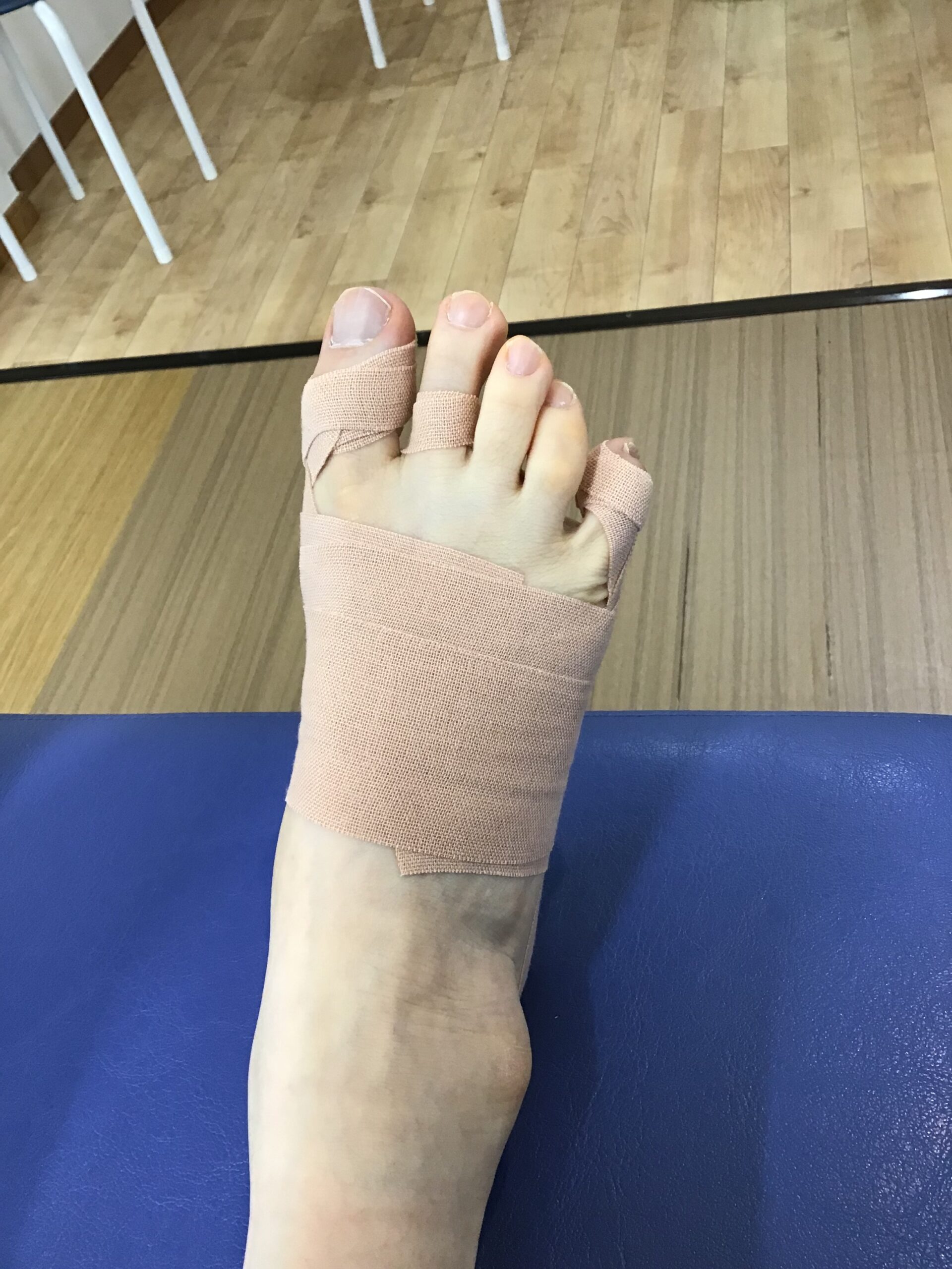 50代女性（練馬区）施術後