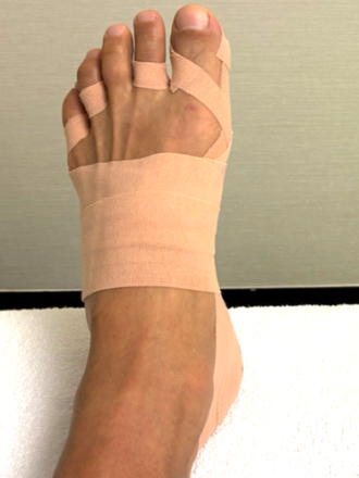 50代男性（茨城県）施術後