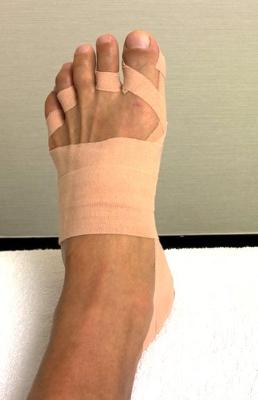 50代男性（茨城県）施術後