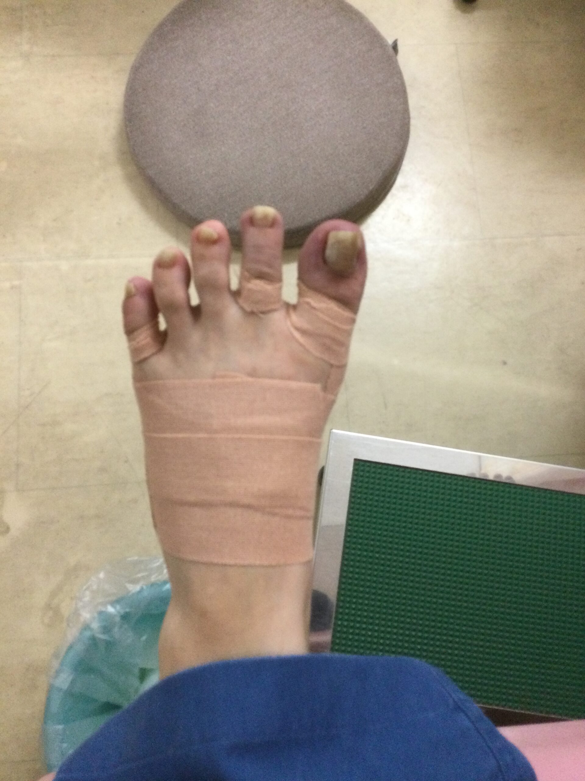 50代女性（八王子市）施術後