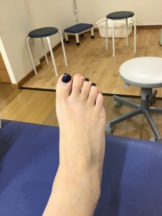 50代女性（練馬区）施術前